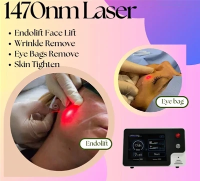 Applicazioni del diodo laser a fibra da 1470 nm 2,5 W